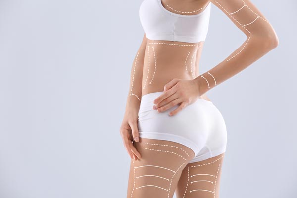 body contouring london